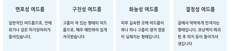 면포성 여드름 구진성 여드름 화농성 여드름 결절성 여드름