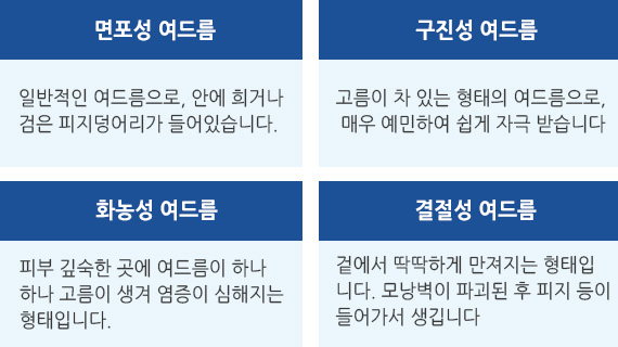 면포성 여드름 구진성 여드름 화농성 여드름 결절성 여드름